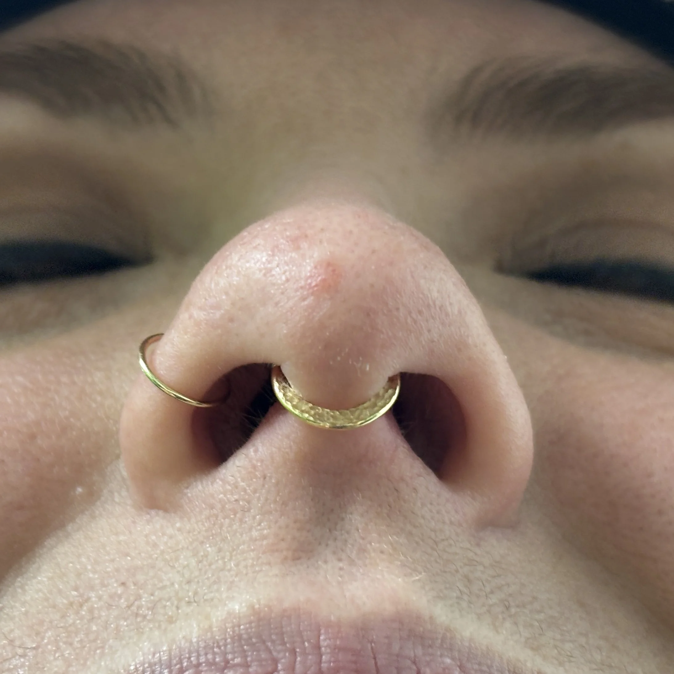 Septum b.JPEG