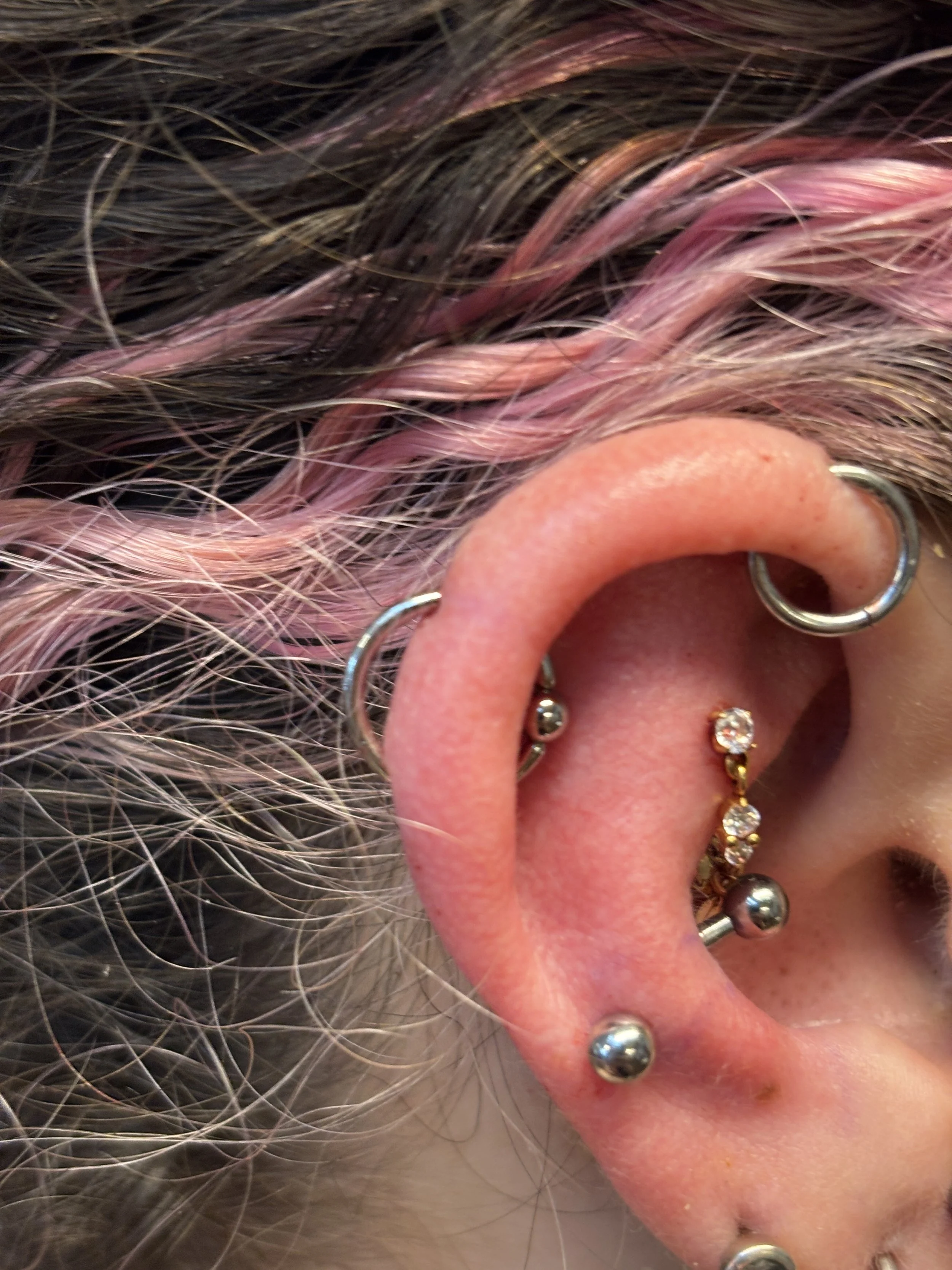Orbital (connected with healed helix), Snug, & stacked lobe