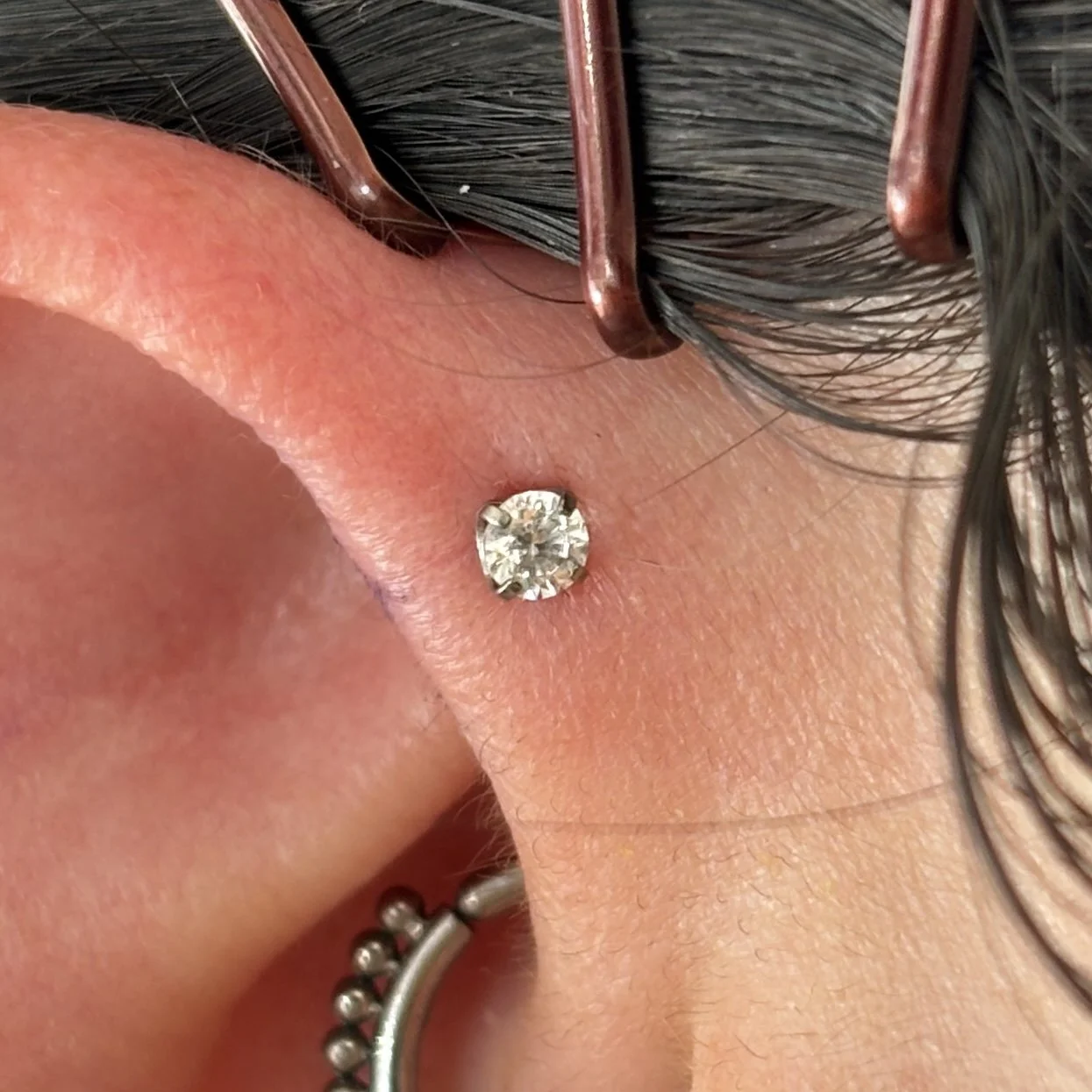 Forward Helix