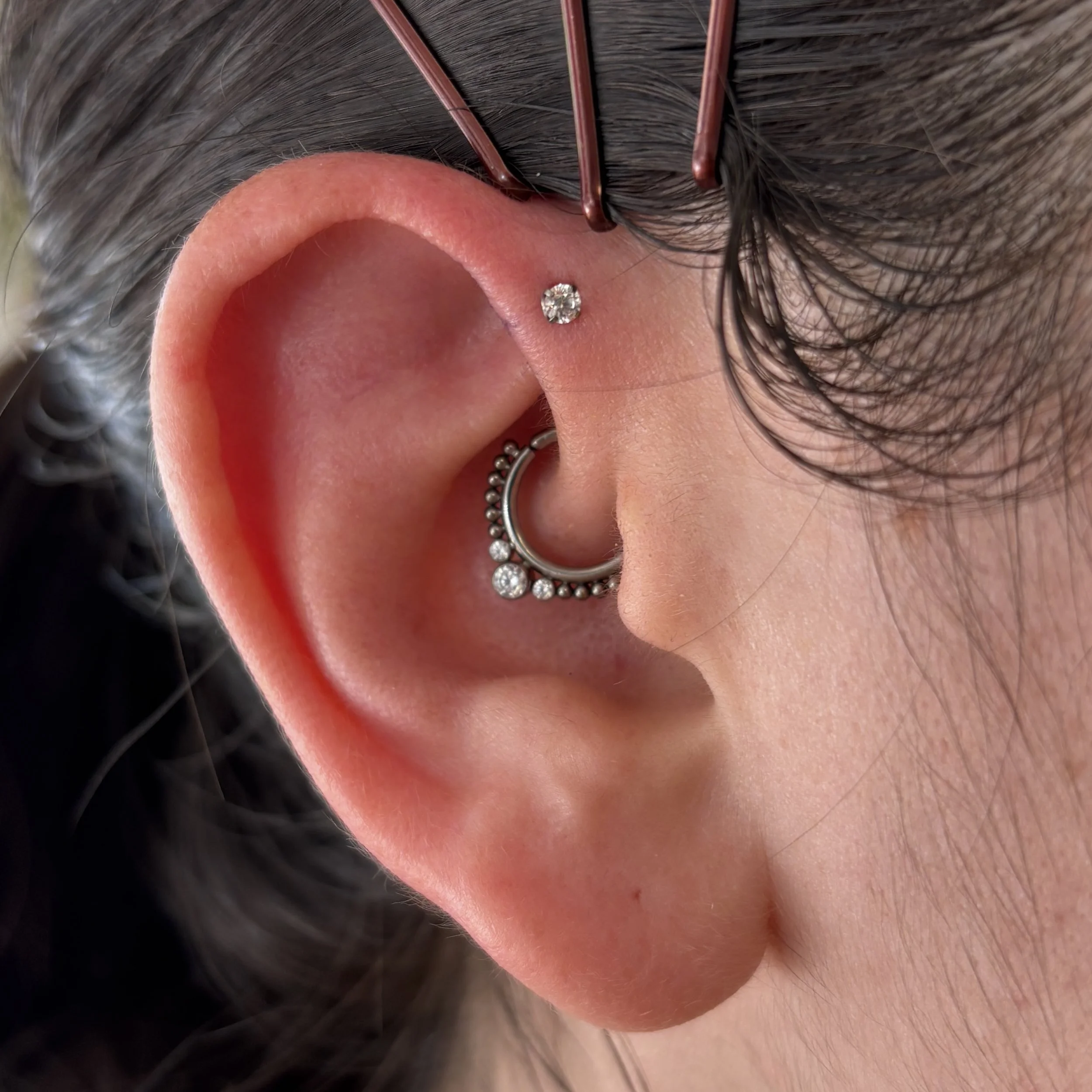 Forward Helix