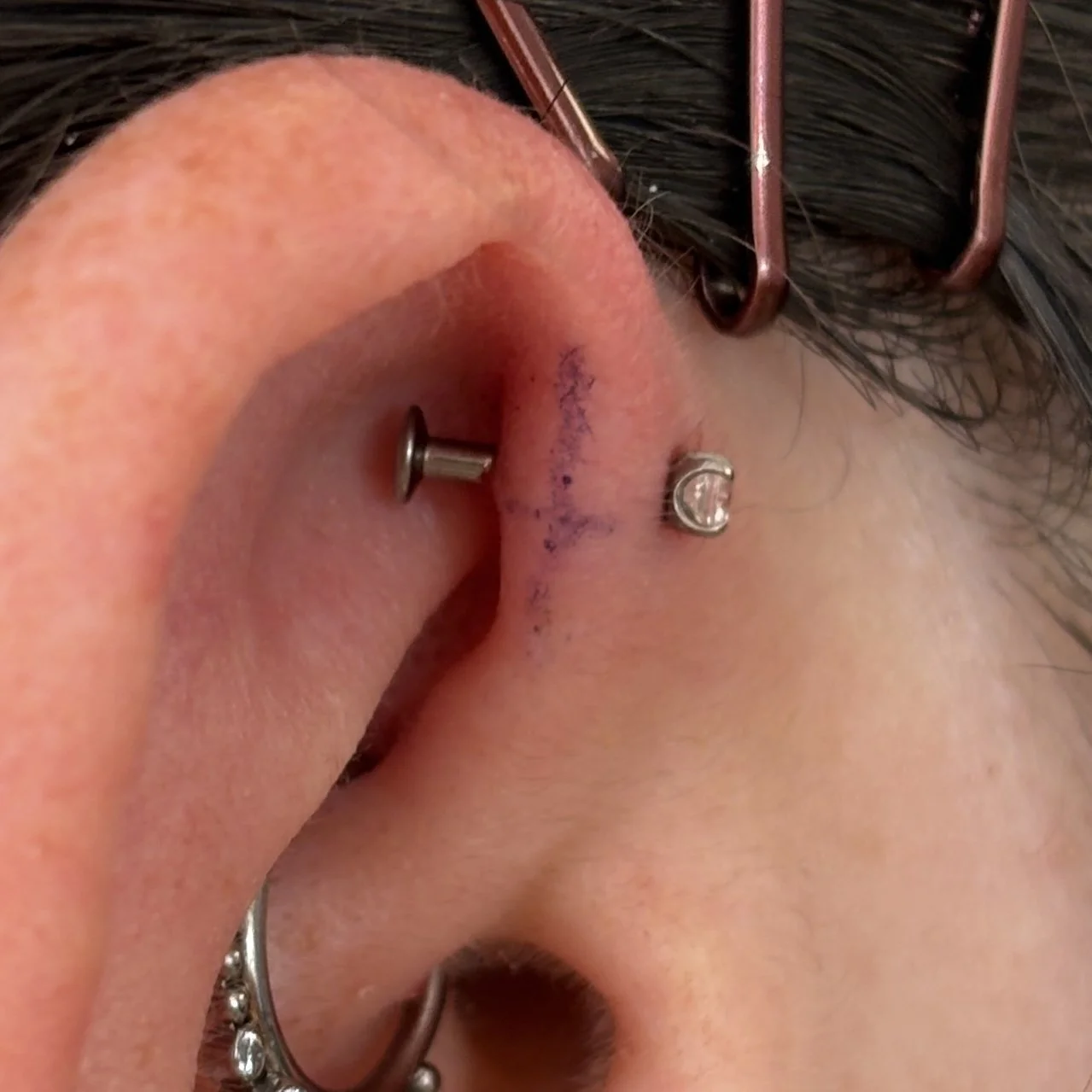 Forward Helix