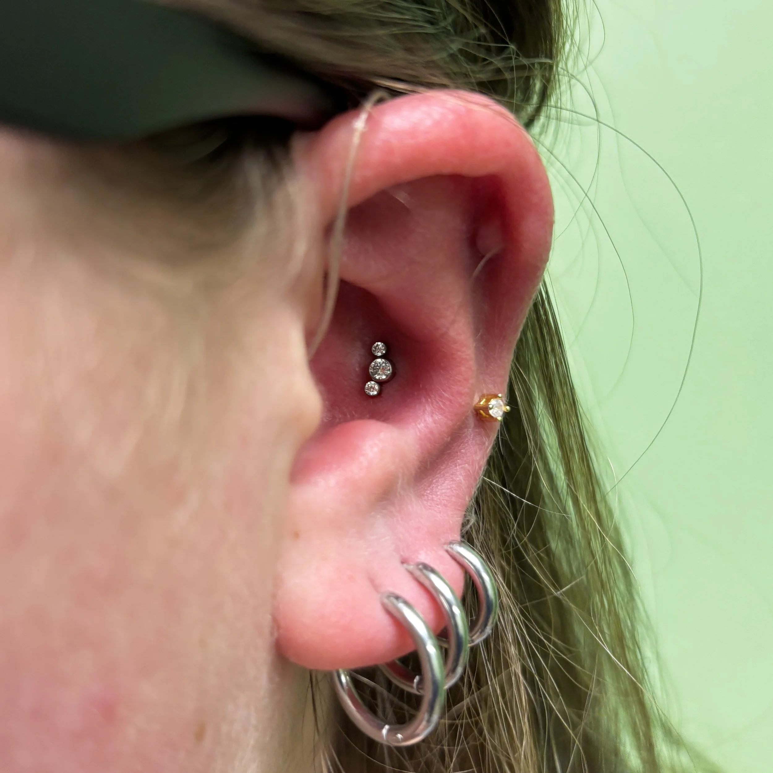 Conch (around hearing aid)