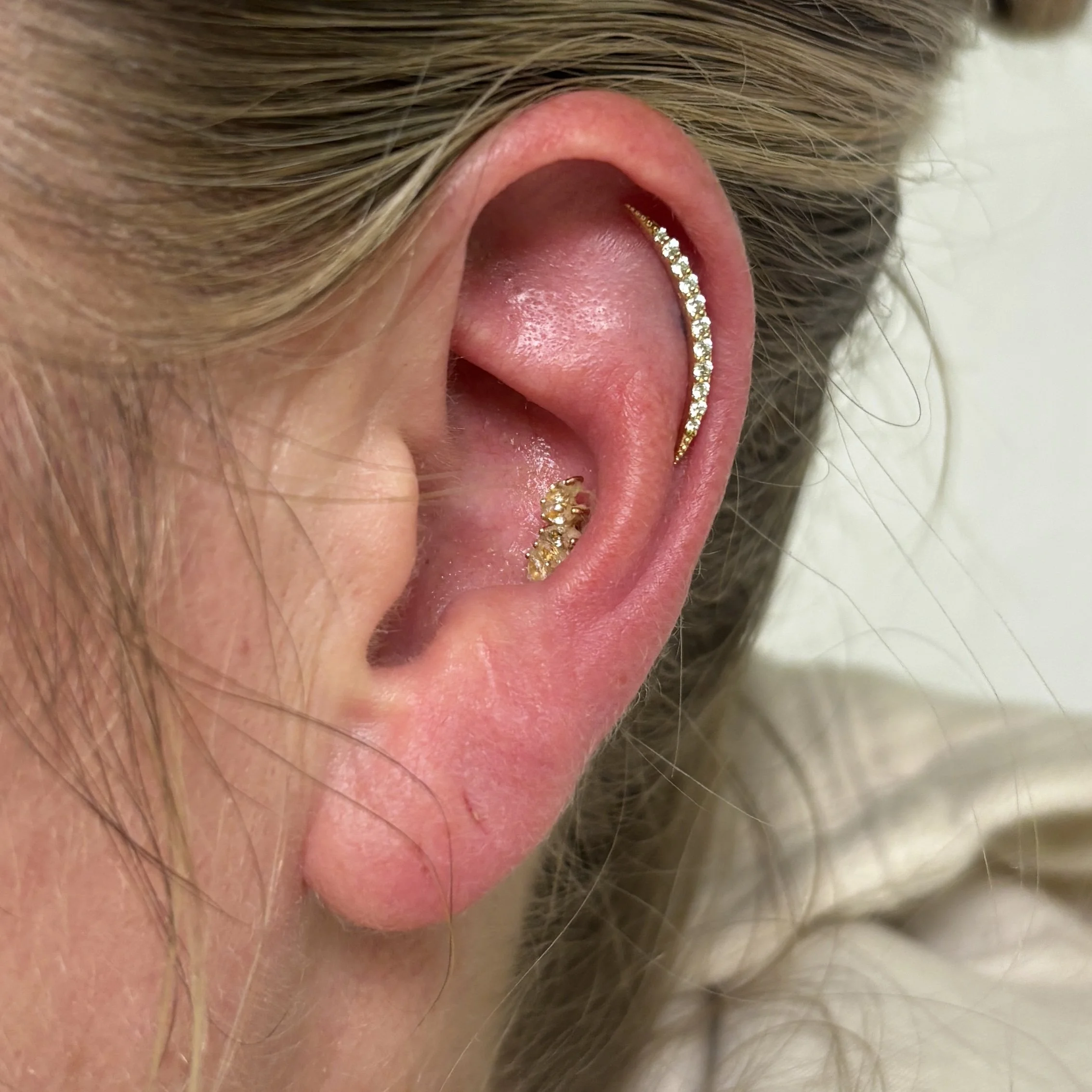 Outer Helix
