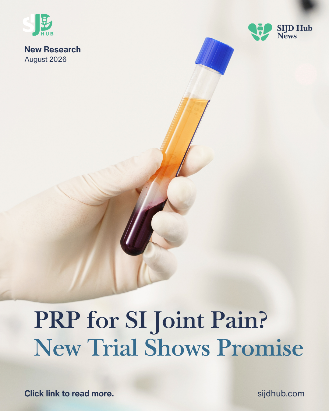 PRP for SI Joint Pain? New Trial Shows Promise