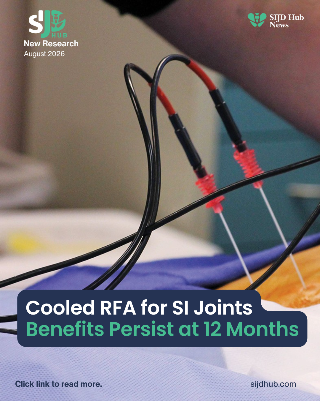 Cooled RFA for SI Joints
