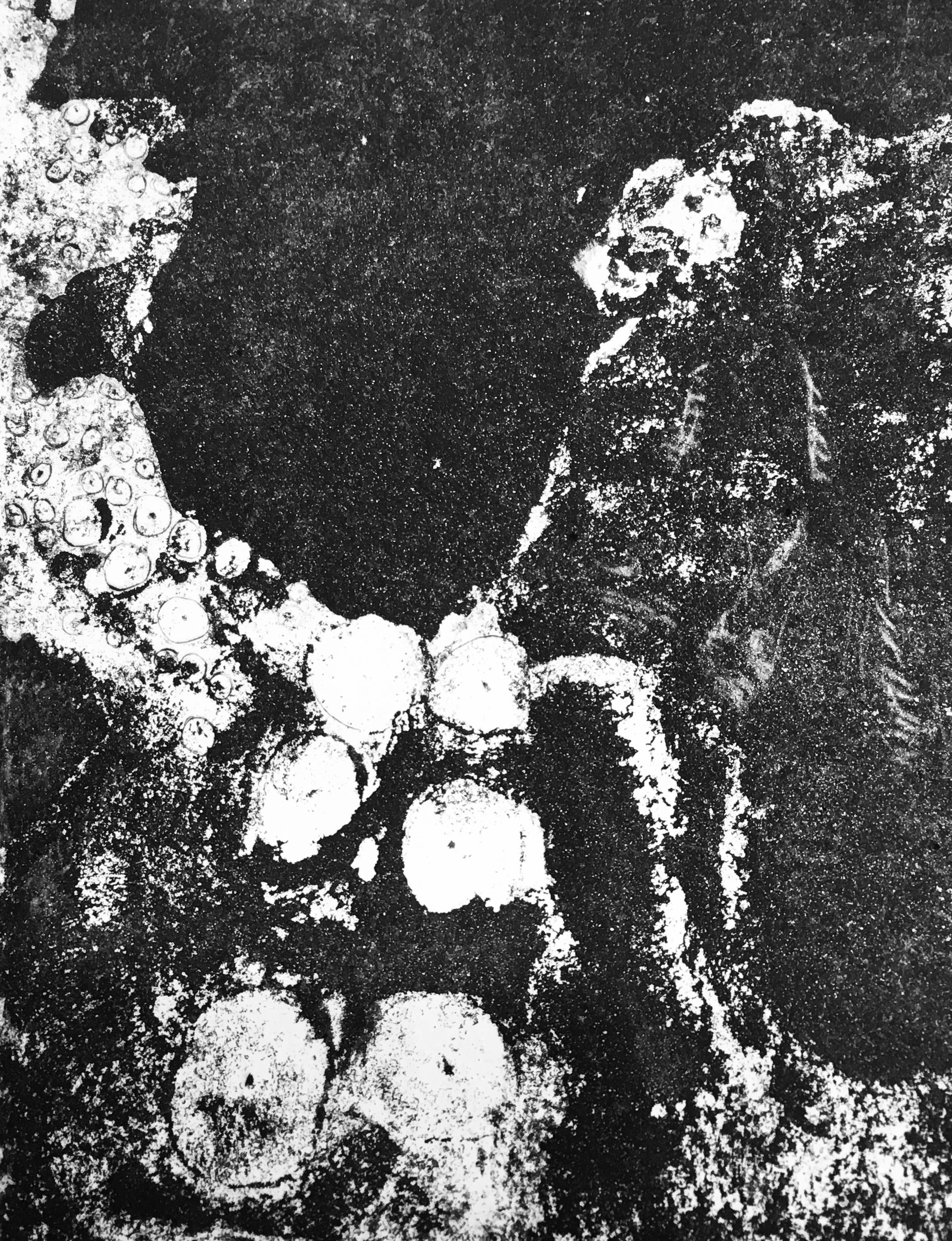 Micrographie en noir et blanc montrant des micro-organismes ronds et filamenteux dans une matrice dense.