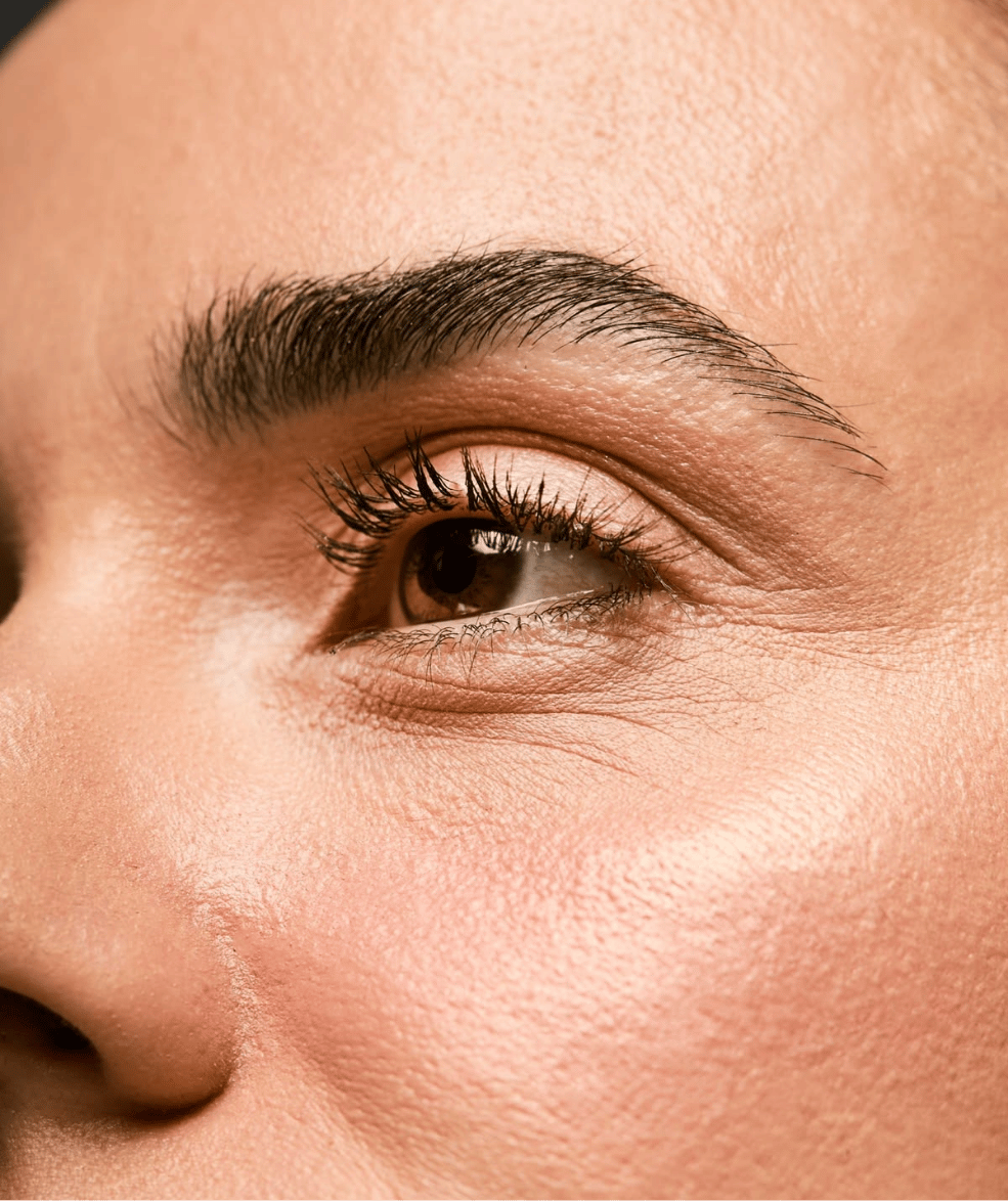 Wrinkle Reduction