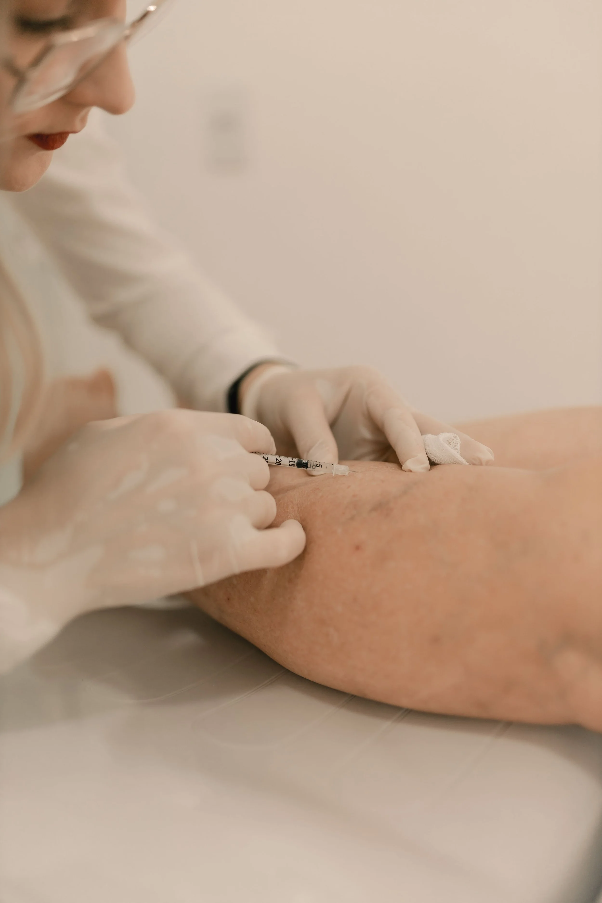 Sclerotherapy