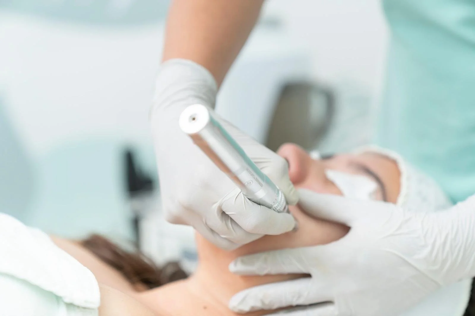 Frau bei einer professionellen Microneedling-Behandlung im Gesicht