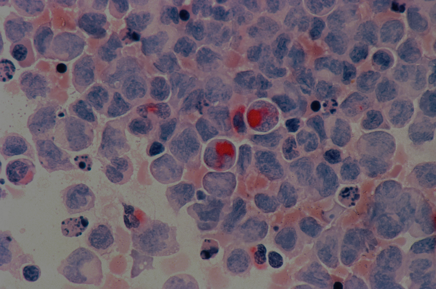 Microscopic view of cells, some with red-stained nuclei, and various other small particles.