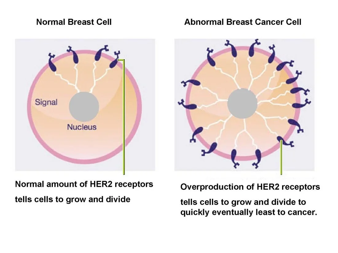 HER2-Positive Breast Cancer