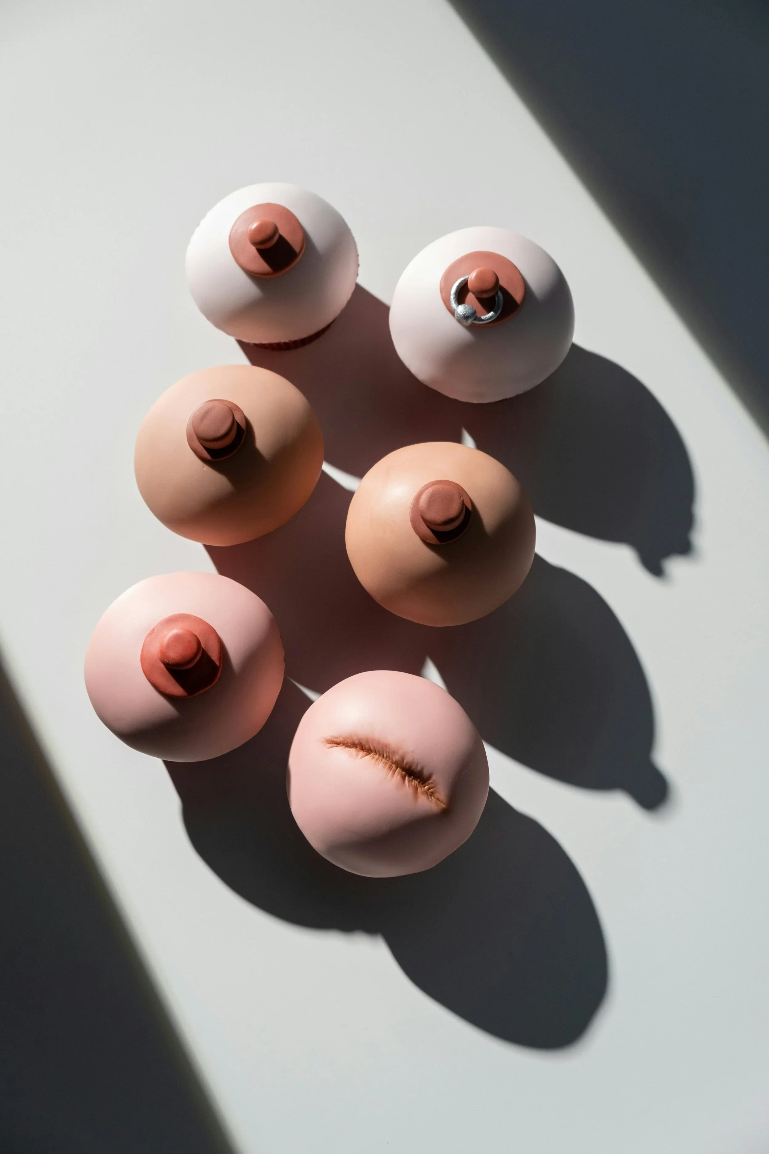 Oncoplastic Breast Surgery