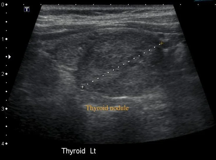 What Tests Do I Need Before Surgery?
