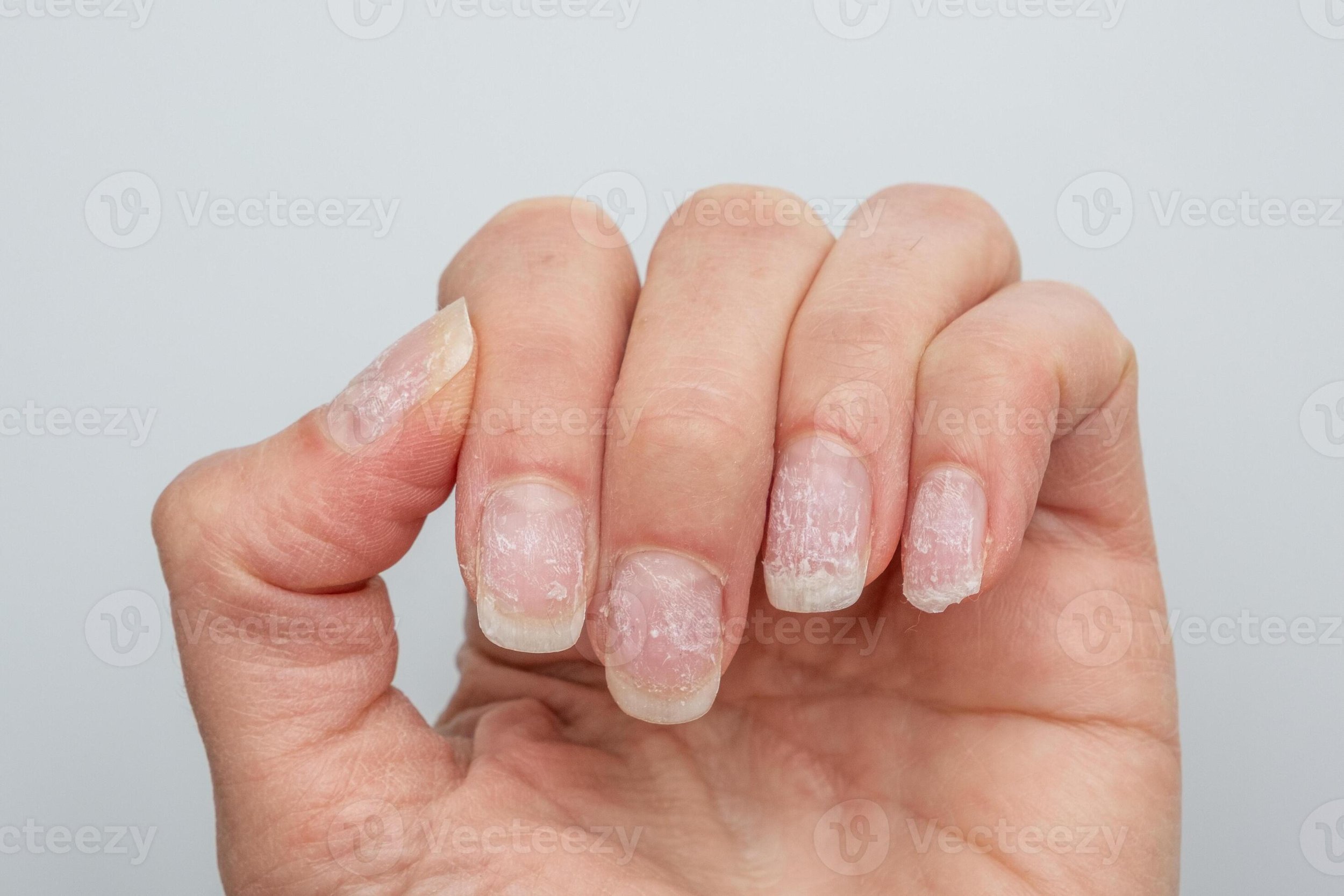 Why Water is Secretly Your Nails’ Biggest Enemy