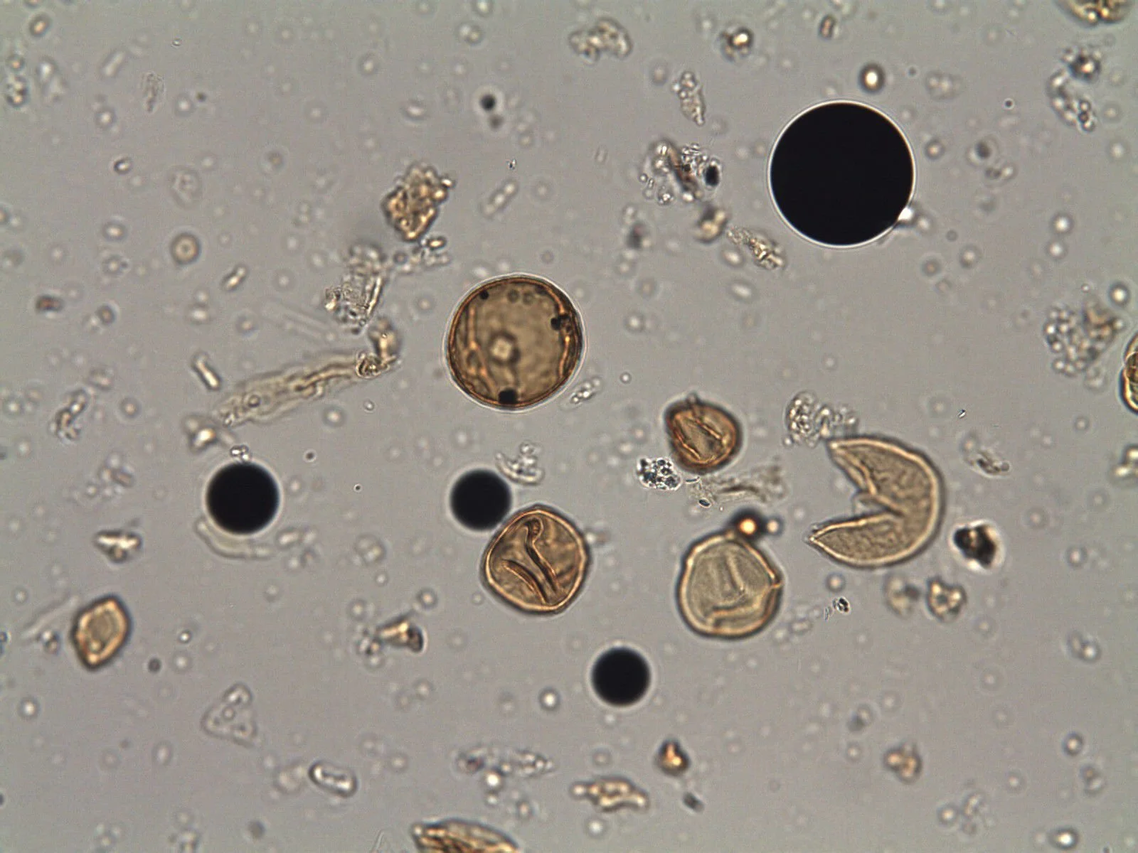 Pollen grains and Palynospheres (2 sizes) (x400 mag)