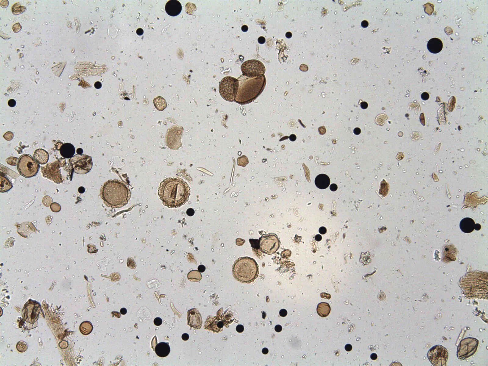 Pollen grains and Palynospheres (2 sizes) (x100 mag)