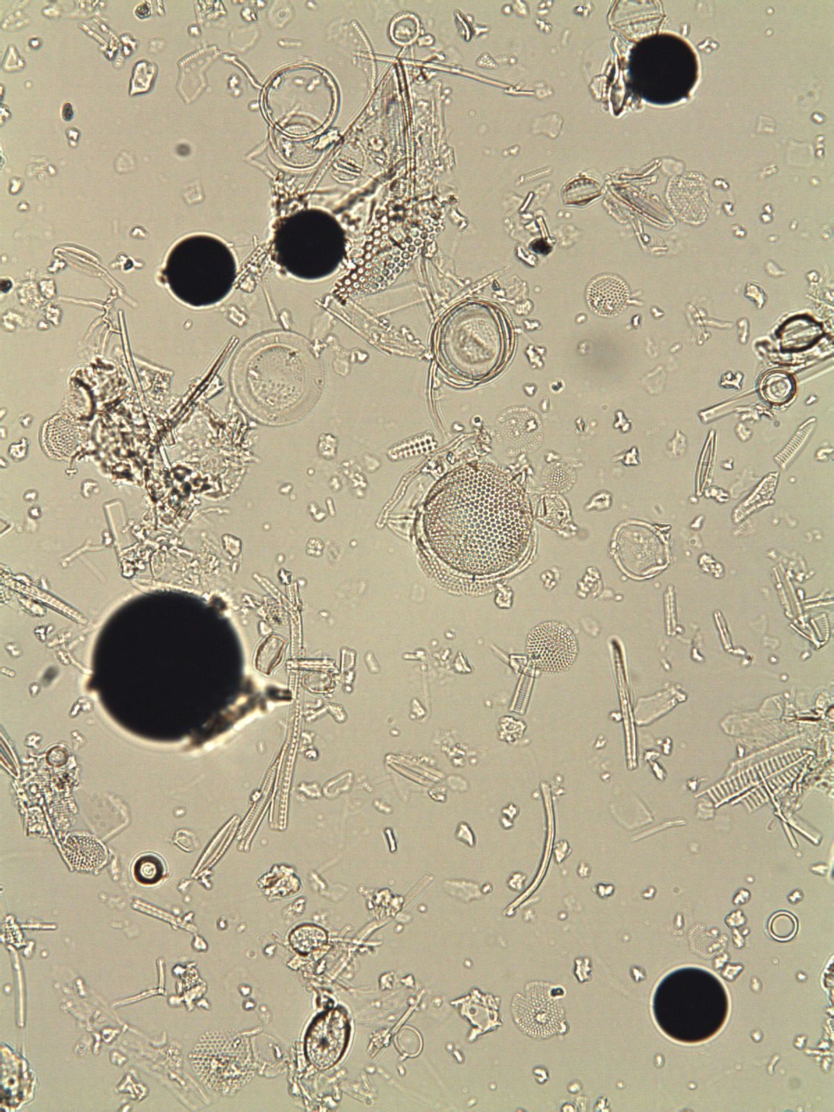 Diatom fossils and Palynospheres (x400 mag)