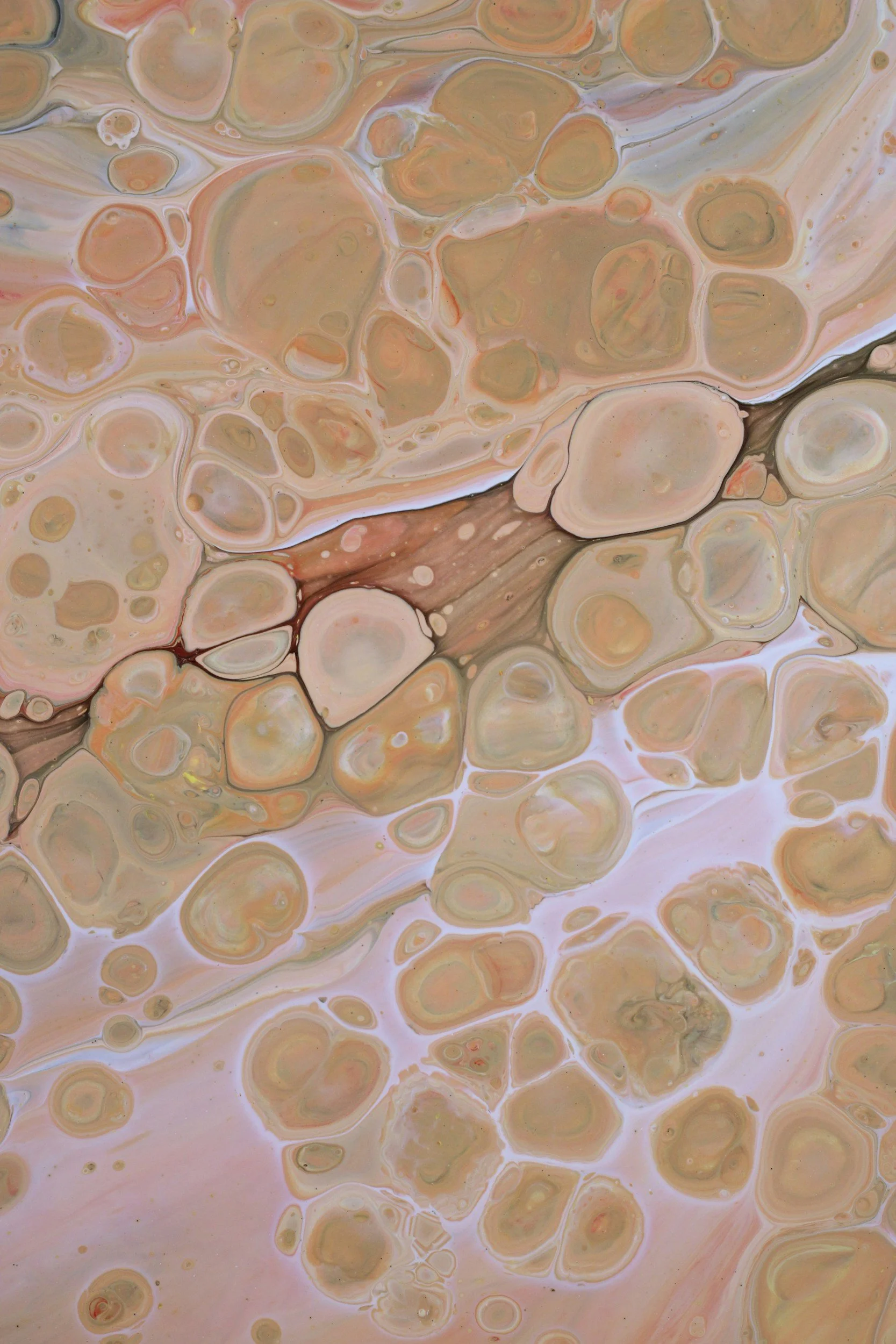 Desmosomes &amp; "Sticky" Skin: Why Dead Cells Refuse to Leave