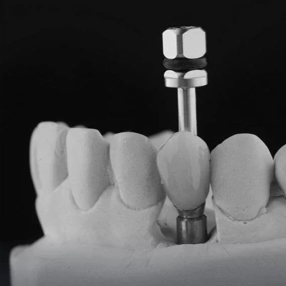 A dental implant model showing an implant post and abutment placed among teeth.