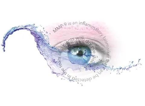 A human eye with a splash of water surrounding it, and text that reads 'MMP-9 is an inflammatory biomarker that patients with dry eye disease.'