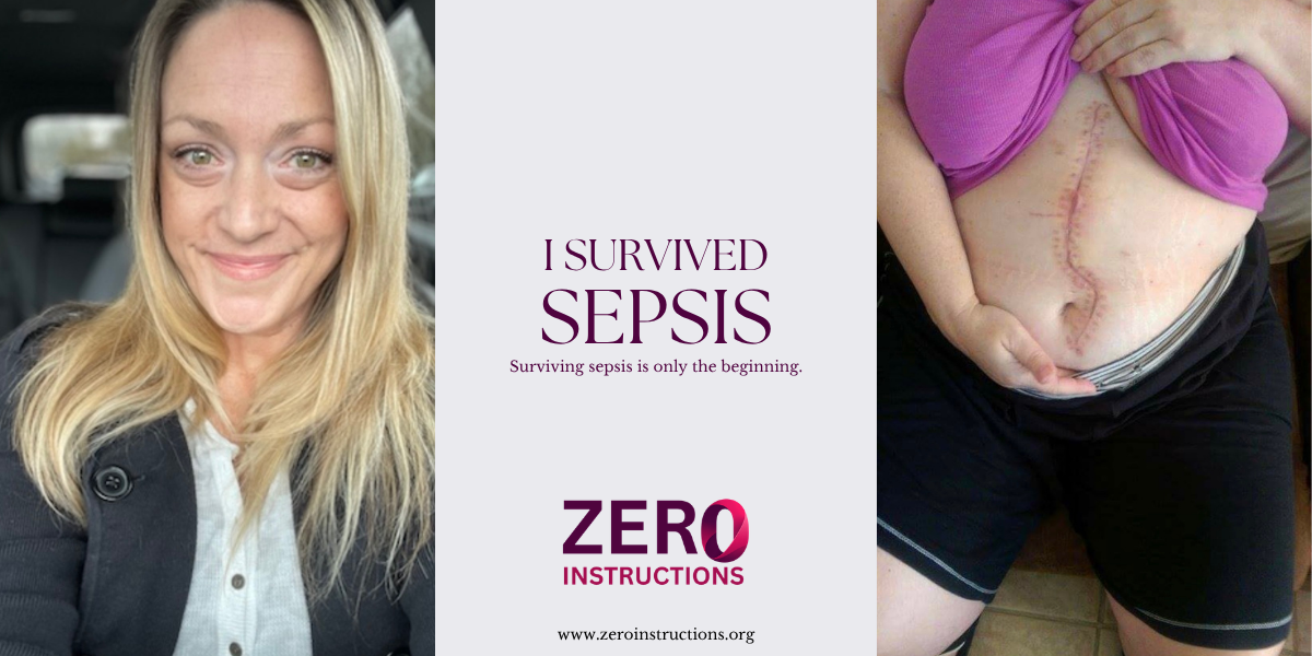 I Survived Sepsis