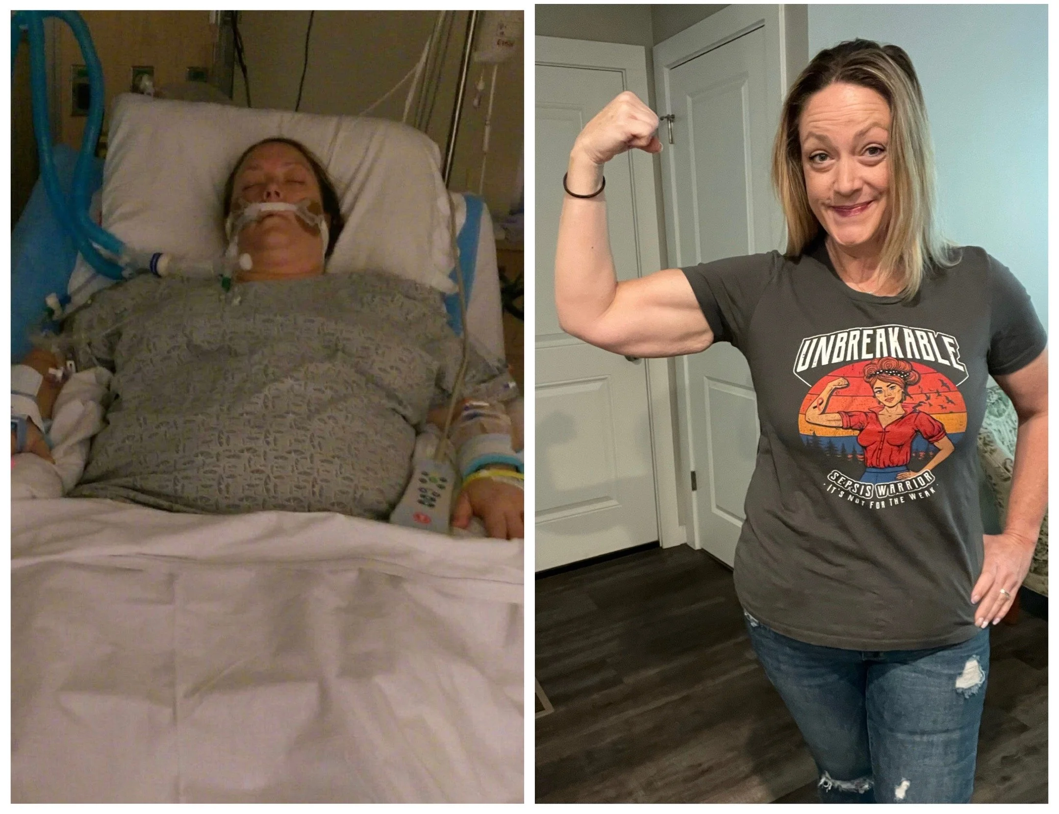 Side-by-side of a woman in a hospital bed recovering before and a woman standing and flexing her arm after recovery at home.