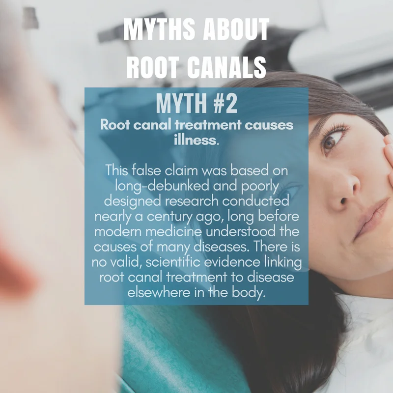 Myths about Root Canals
