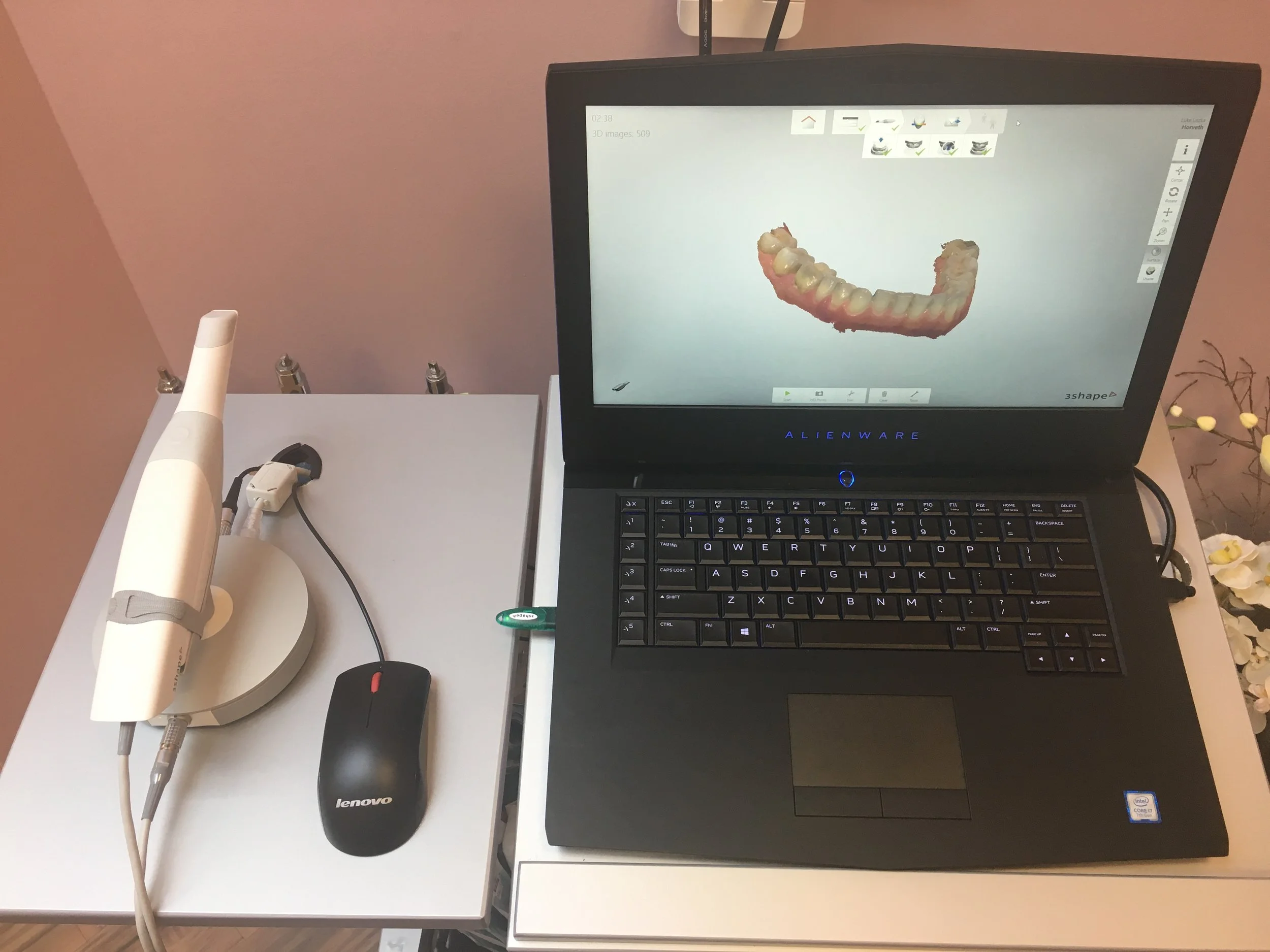 New 3D Digital Impression Scanner