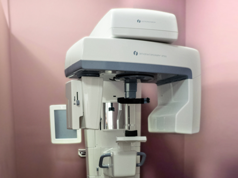 Digital X-Ray Scanner - Perio and Endo Calgary