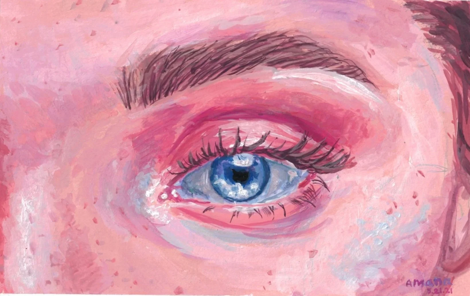 pinkeye3000.jpg