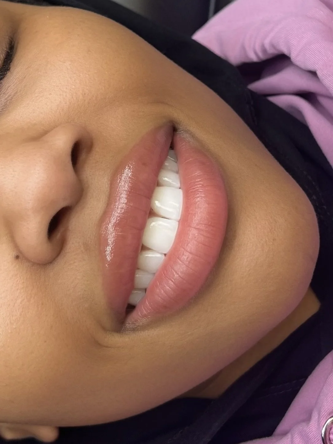 Close-up of a smiling person with light brown skin, showing white teeth and pink lips, lying down with a black garment and pink fabric visible.