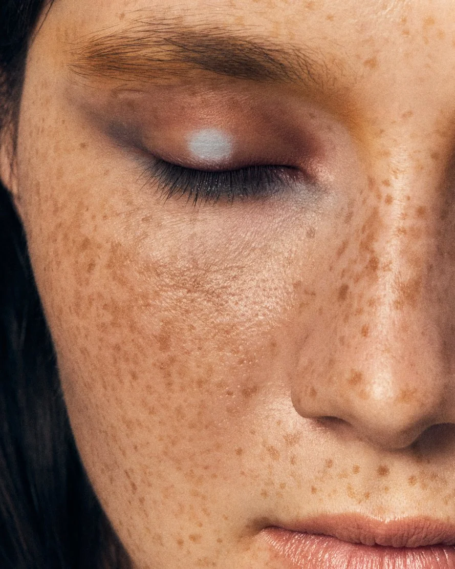 Zoom sur un visage avec une peau pâle, de nombreuses taches de beauté ou taches de rousseur, et un œil fermé avec un maquillage léger.