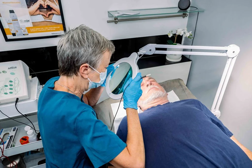 Sarah Hurst performing Advanced Electrolysis on a client using a fine probe and magnifying lamp at her Brighton clinic.