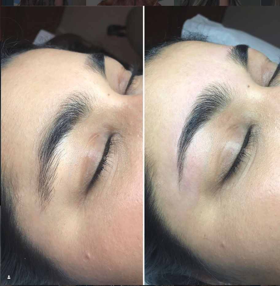Close-up of a woman's face with her eyes closed, showing her eyebrows before and after a cosmetic procedure to enhance their appearance.