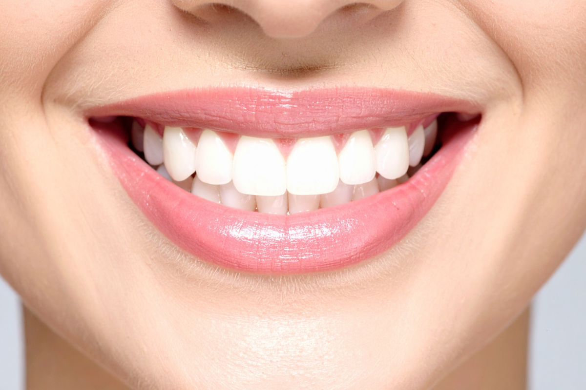 Close-up of a bright smile representing dental services for weddings and special events