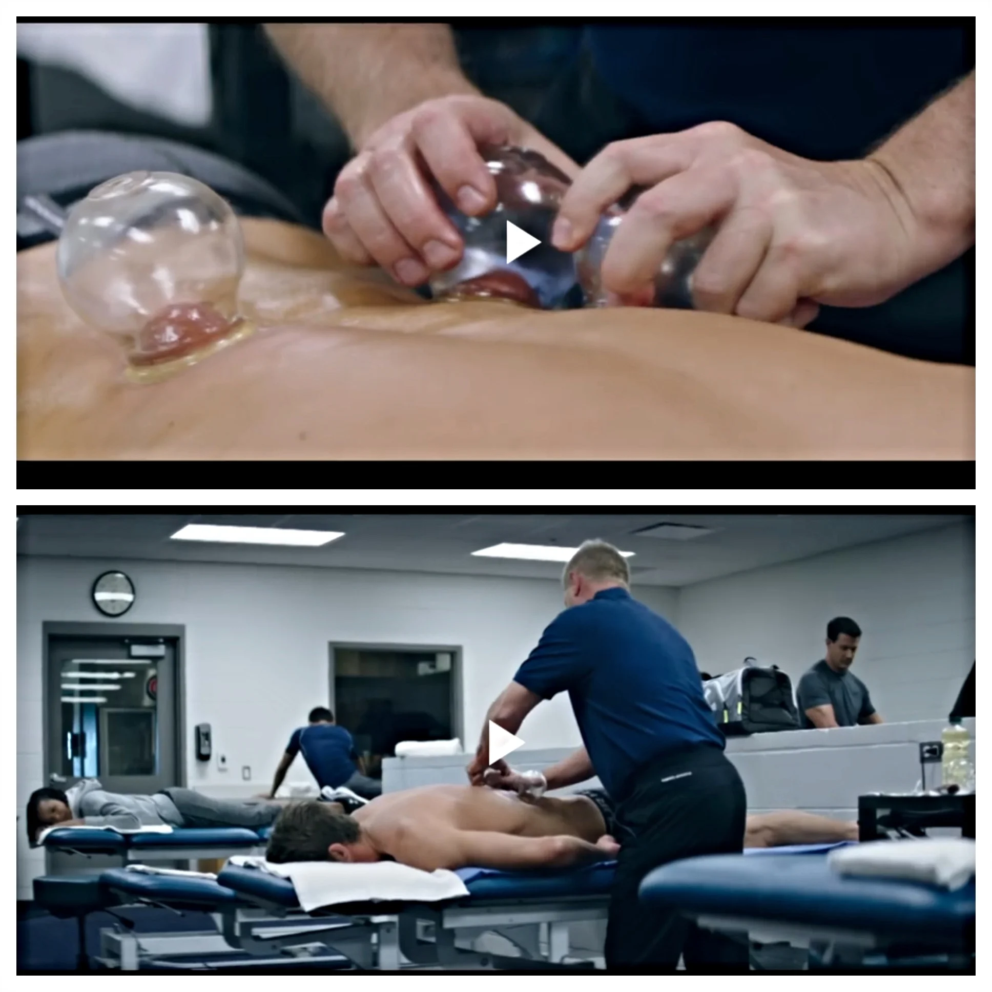 Michael Phelps gets Cupping