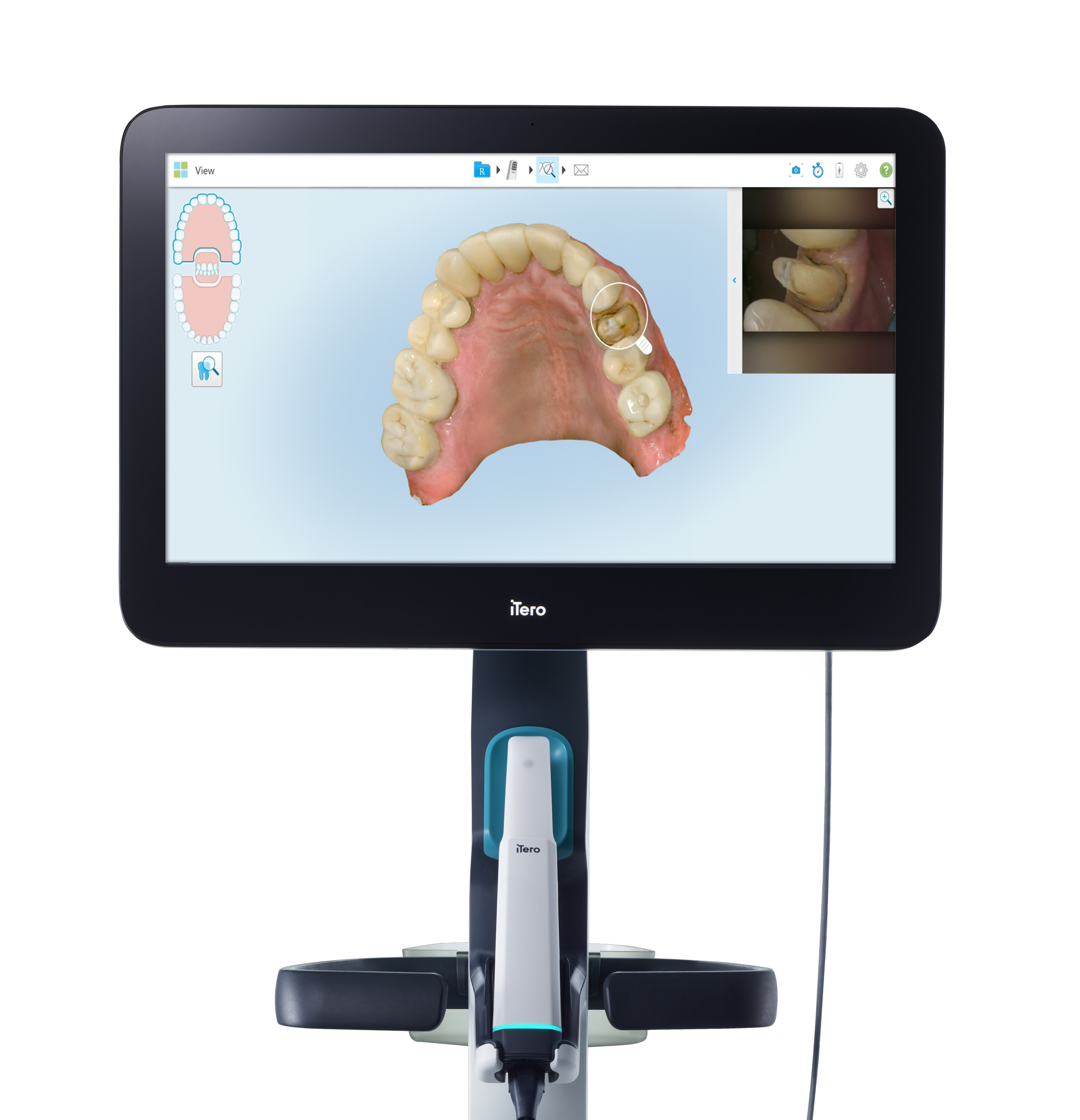 The image shows a digital dental scanner with a 3D model of the upper teeth and gums displayed on its screen, alongside a live camera feed of the patient's mouth.