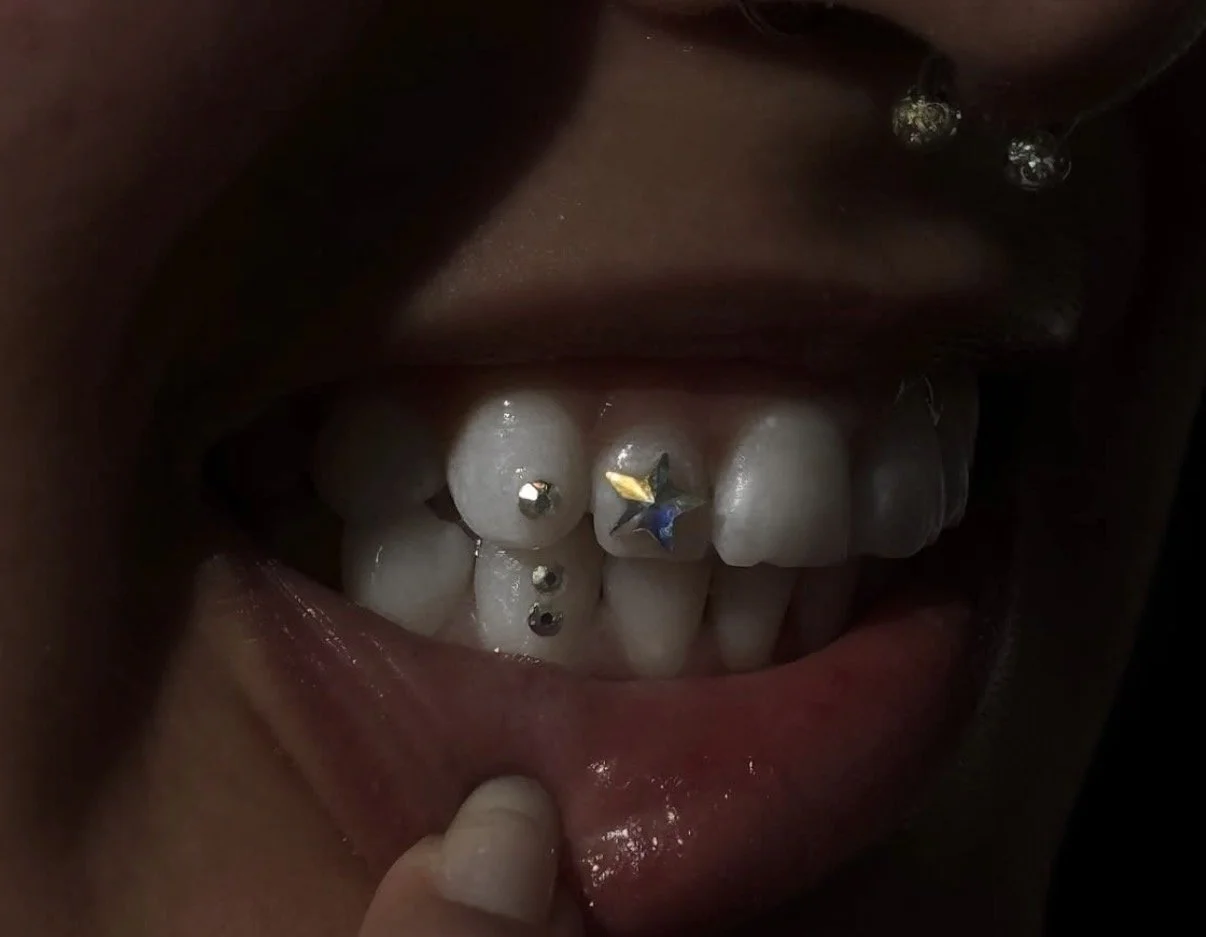 Tooth Gems