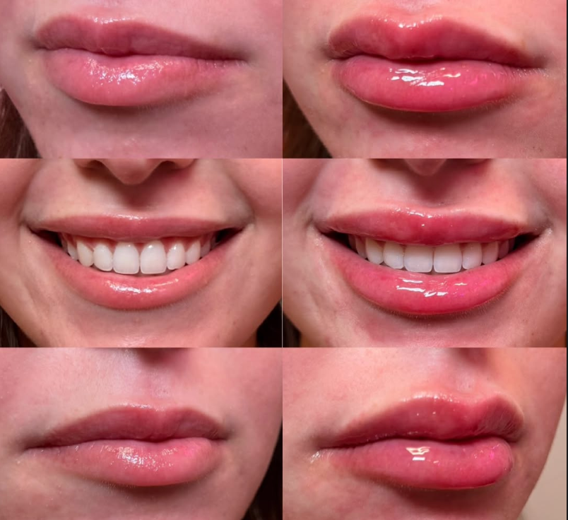 Close-up of a person's lips in different expressions and angles, with some showing teeth and glossy lips.