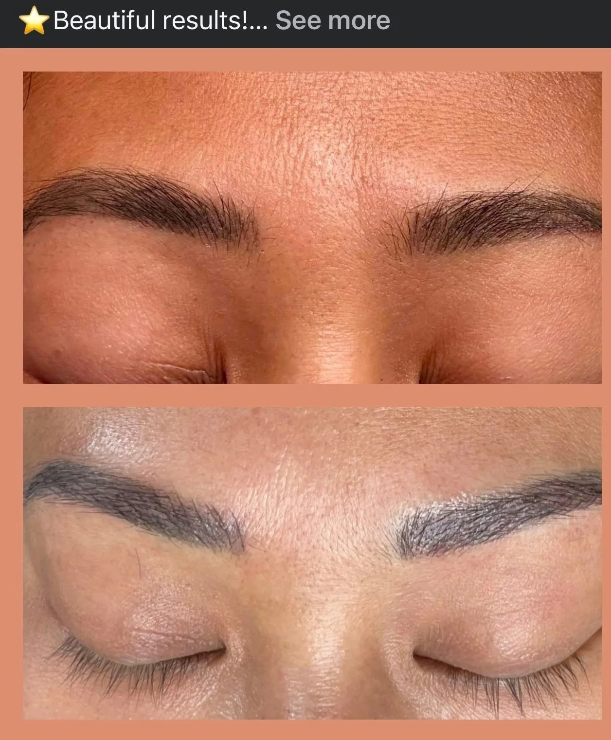 Close-up comparison of eyebrows and upper eyelids before and after cosmetic enhancement or correction.