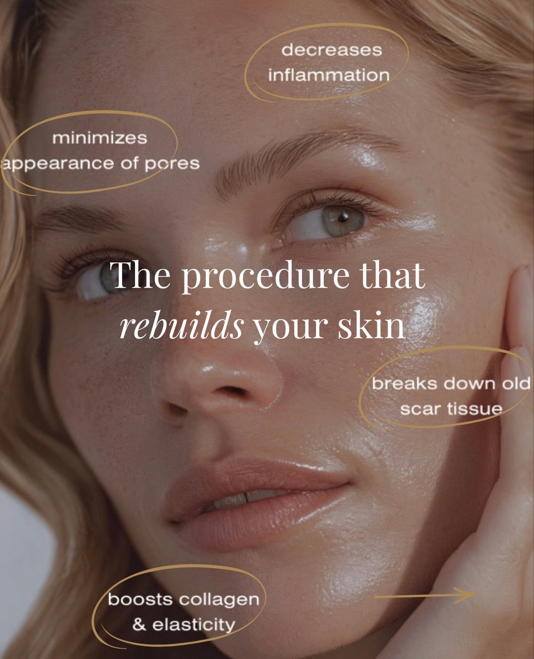 There was a time I wouldn&rsquo;t leave the house without makeup on because of the overall dull texture, fine lines, and hyperpigmentation on my face &mdash; I didn&rsquo;t feel confident barefaced.

Today, while my skin is by no means perfect, I can