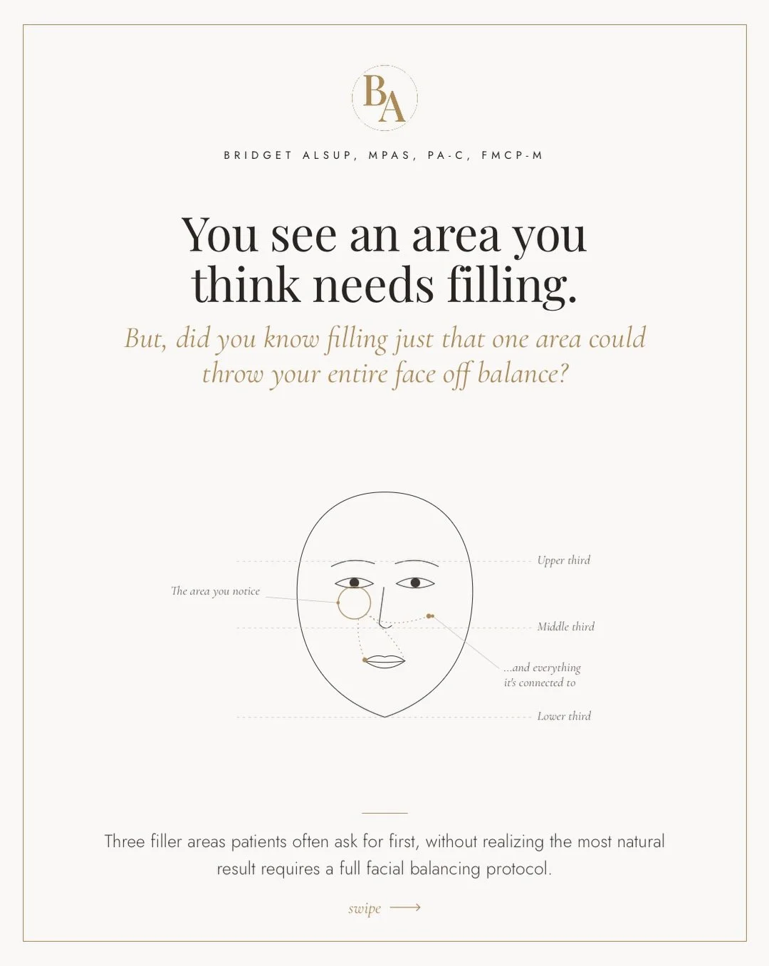 You see a hollow, a fold, a flat spot, and filling it feels like the obvious answer. But, that area is usually the result, not the cause. Filled on its own, it can throw off the balance of your entire face.

Here&rsquo;s why: Your face ages in layers