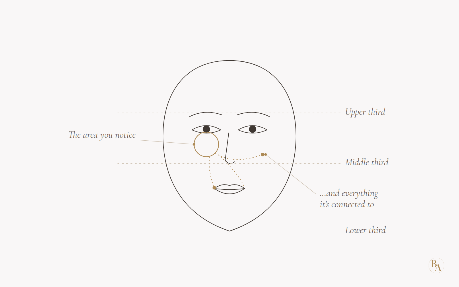 Line drawing of a face divided into upper, middle and lower thirds, with the under-eye circled and dotted lines linking it to the cheek and lips.