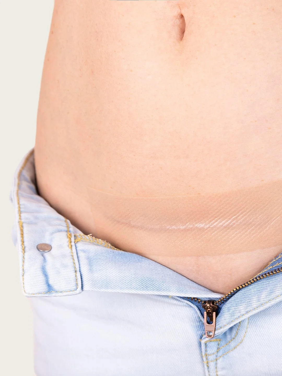 C-Section Patch.jpg