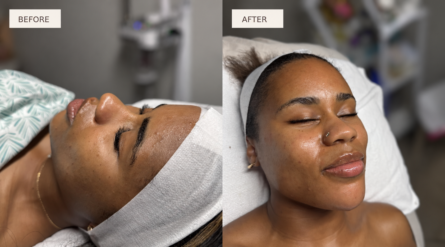 Client during and after a customized facial at Mi Piel Beauty Bar in Beltsville, MD.