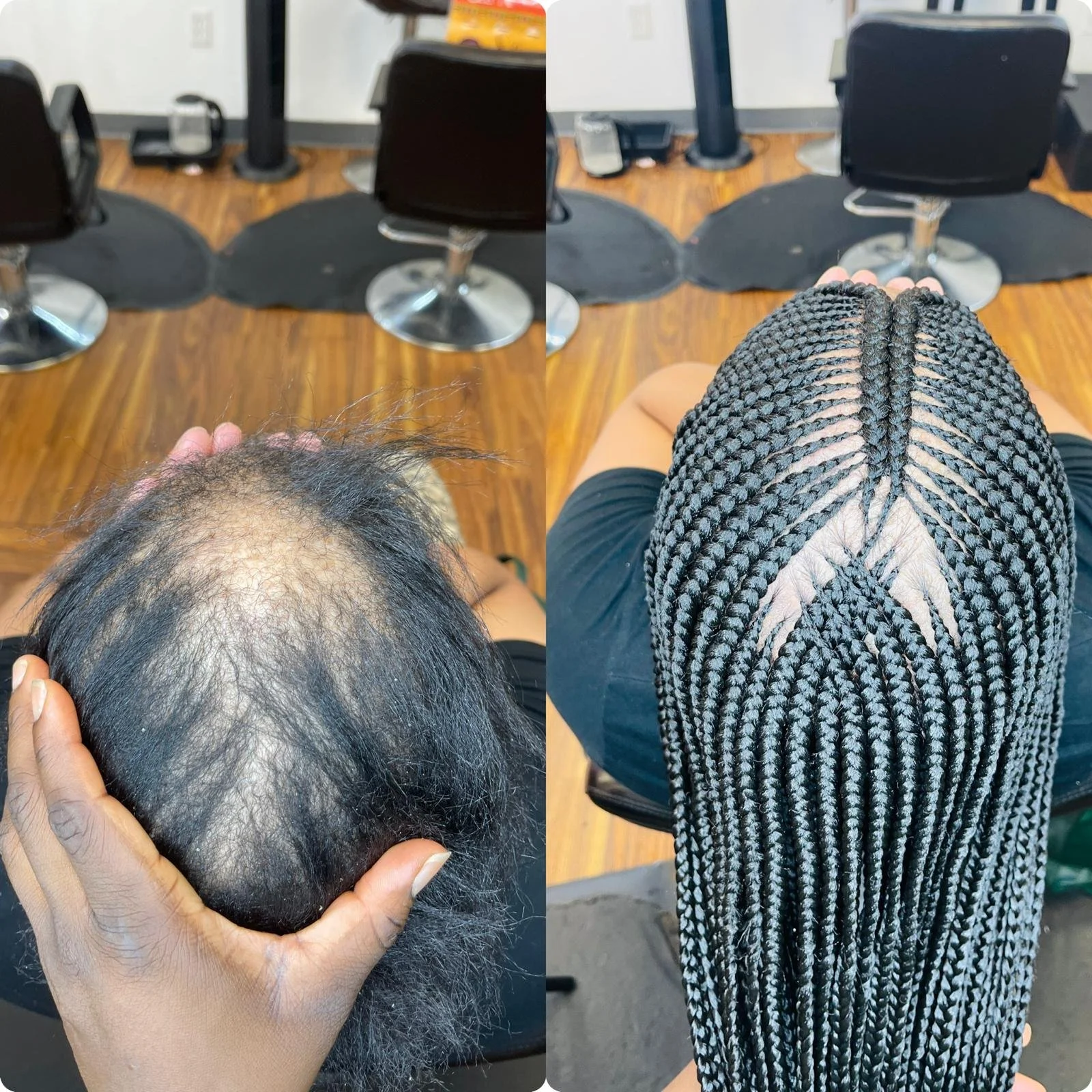Comparison of a person's hair before and after getting box braids. The left shows the person with a bald and thinning scalp, and the right shows the person with neatly styled, long, black and white box braids.