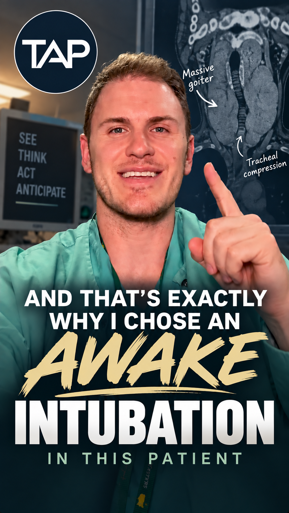 A smiling male healthcare professional in scrubs pointing upward. In the background, there is an MRI scan of a brain with annotations indicating a 'Massive goiter' and 'Tracheal compression.' On the left, a monitor displays the words 'SEE THINK ACT ANTICIPATE.' A circular logo with the word 'TAP' is in the top left corner. The text on the image reads, 'AND THAT'S EXACTLY WHY I CHOSE AN AWAKE INTUBATION IN THIS PATIENT.'