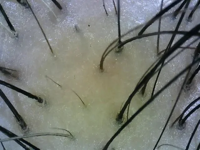 Close-up of grass or plant stems growing through a wet, foam-like surface.