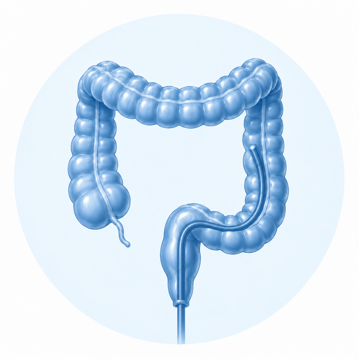 Illustration of the human large intestine and rectum in blue.