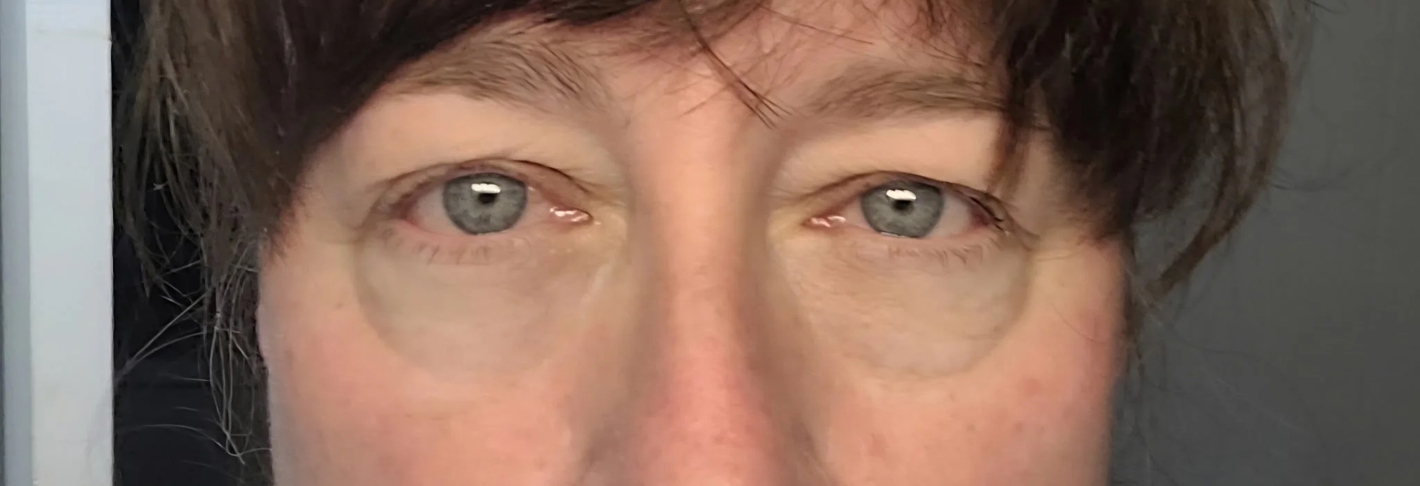 eye2.jpg